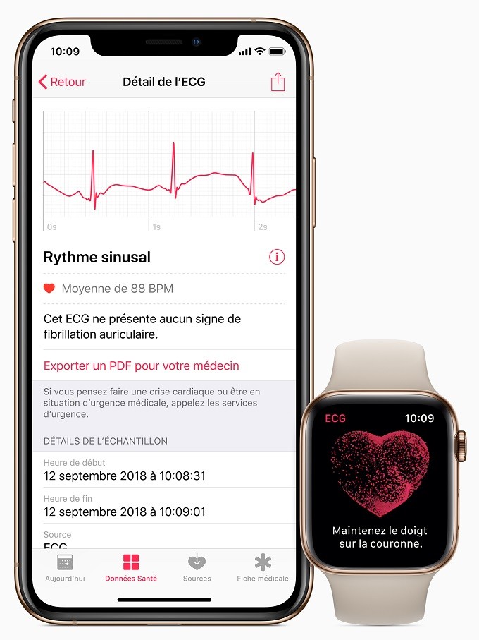 L'électrocardiogramme avec l'Apple Watch Series 4 disponible en France