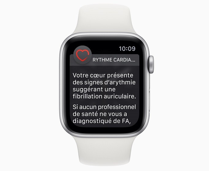 L'électrocardiogramme avec l'Apple Watch Series 4 disponible en France